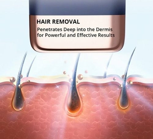 Focus on facial, underarm, private parts, bikini local hair removal MLAY T14 home IPL hair removal device