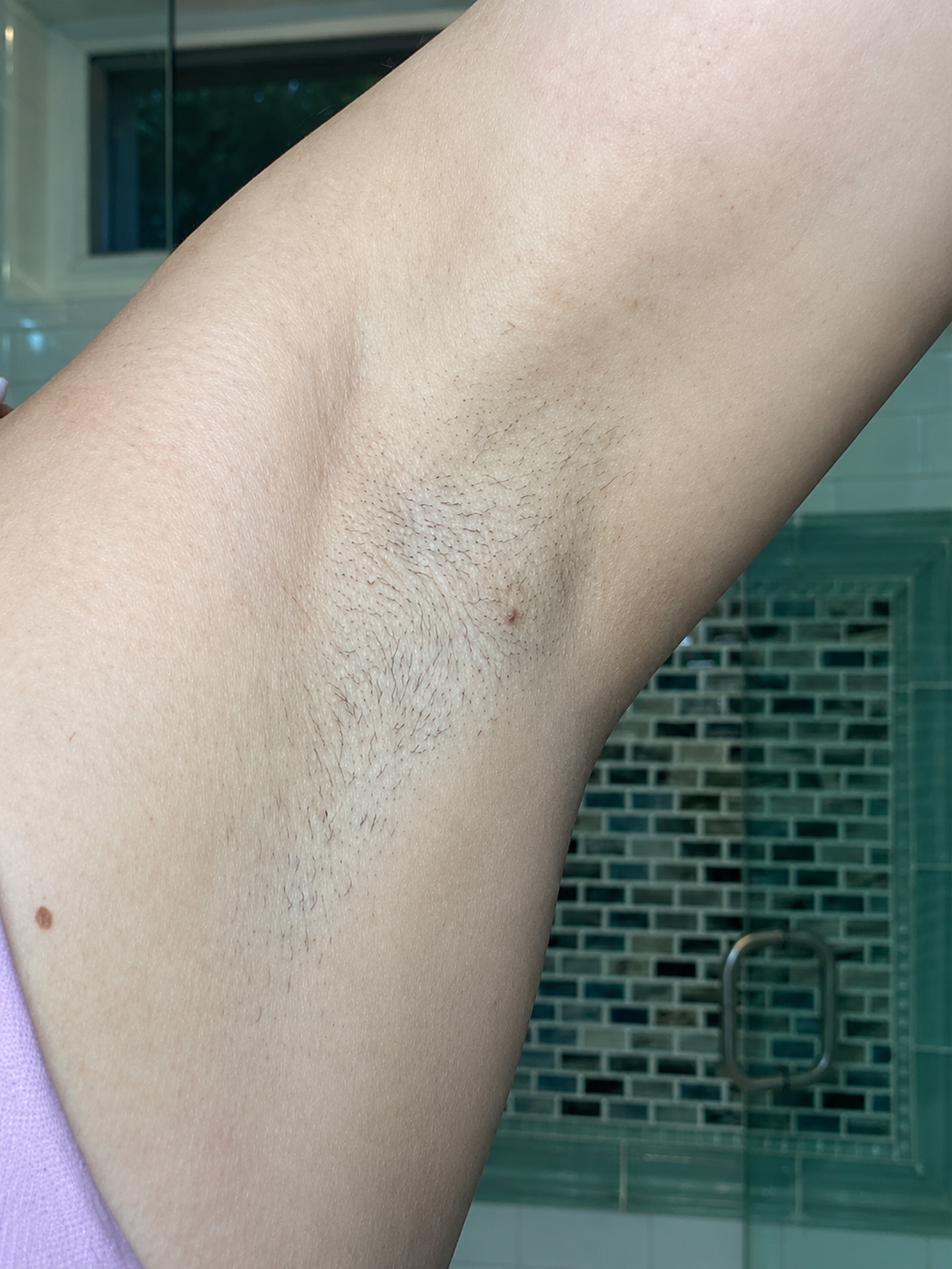 Before