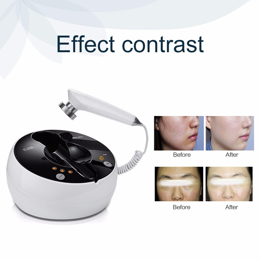 Desktop RF Beauty Device RF01